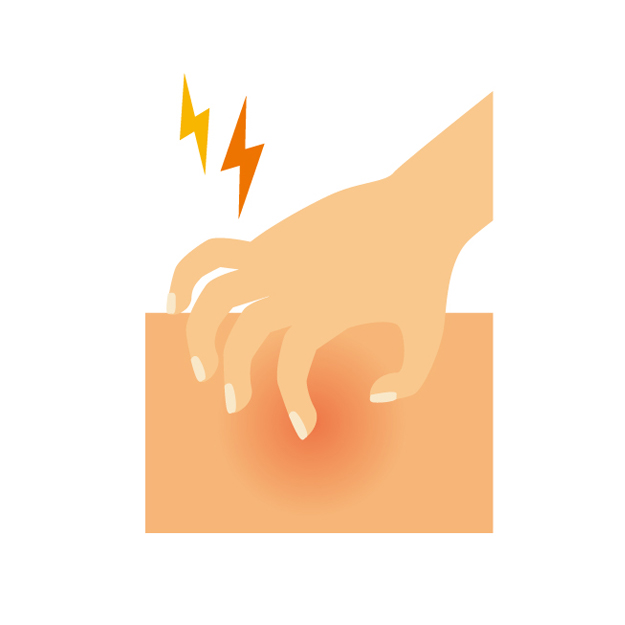 湿疹・皮膚炎用薬